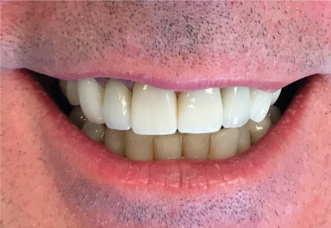 After Vita dental spa dental treatment